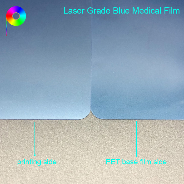 8"*10" Blue Finish Laser Printing Medical X-ray Film for Dry Digital Laser Printer China Supplier